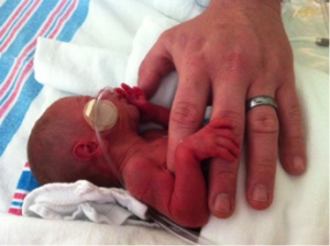 preemie baby