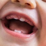 tips for taking care of your baby's teeth