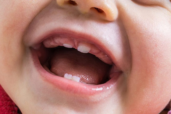 Close Photo Crying Months Old Baby Mouth Bare Gums Teeth Stock Photo By  ©aksenovko 222980820