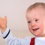 Down syndrome: an overview