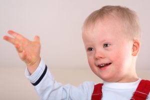 Down syndrome: an overview