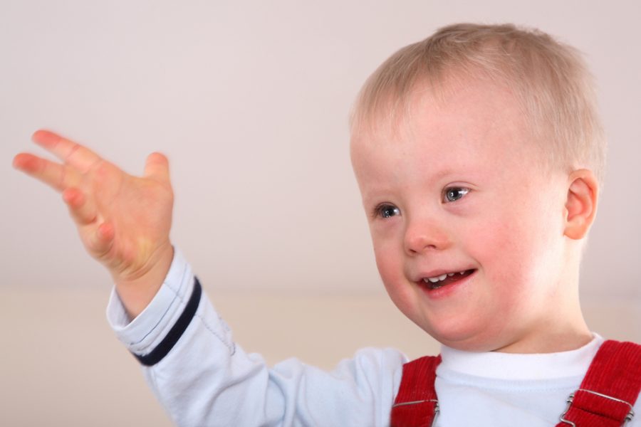 Down Syndrome: An Overview
